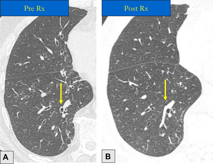Figure 6
