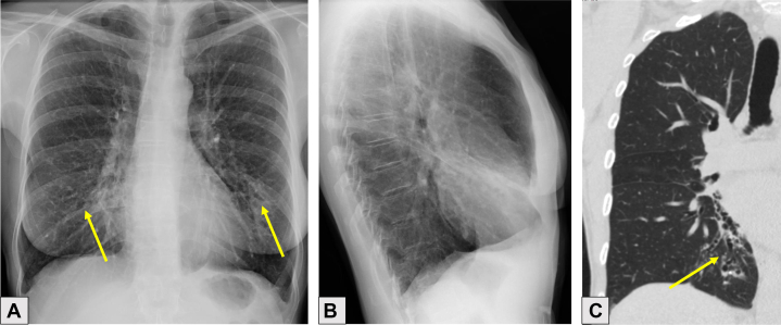 Figure 16