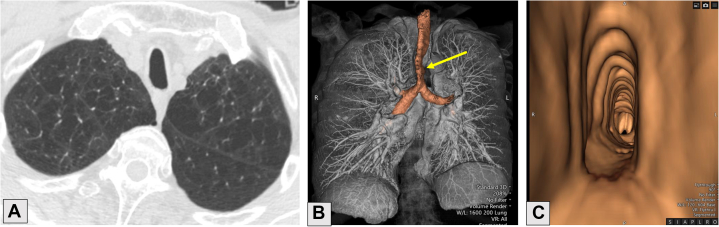 Figure 19