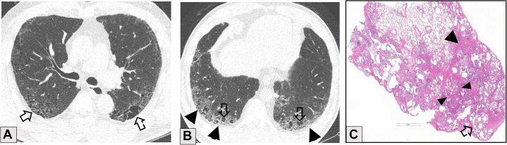 Figure 14