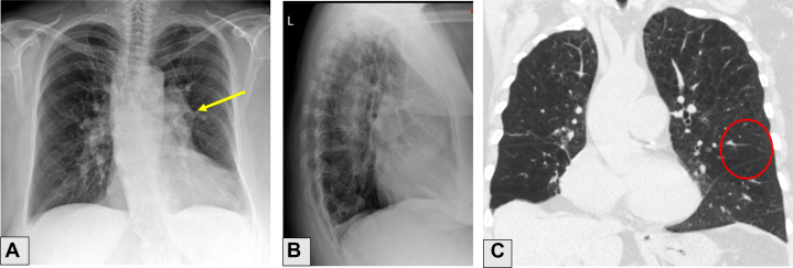 Figure 18