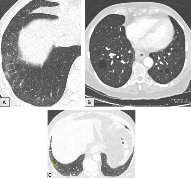 Figure 15