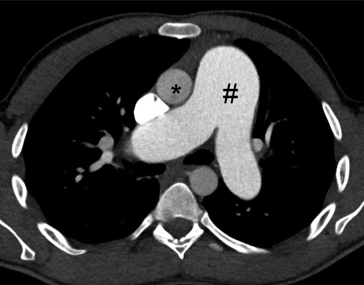 Figure 17