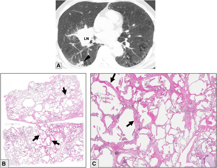 Figure 12