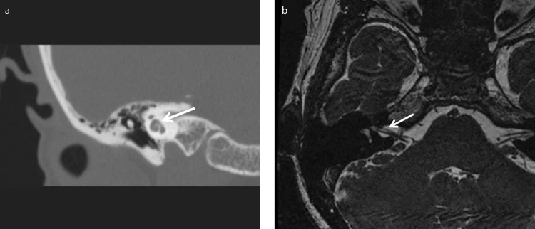 Figure 2. a, b