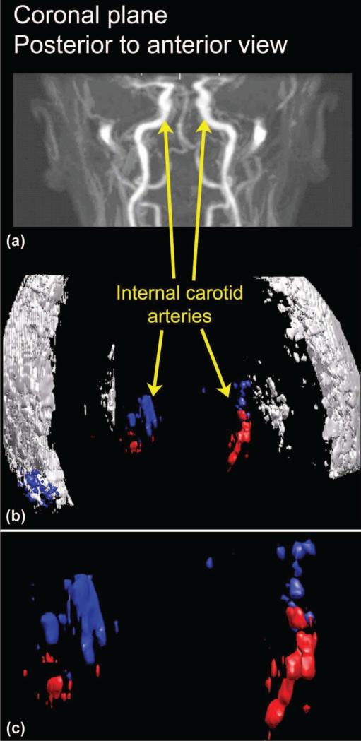 Fig. 10