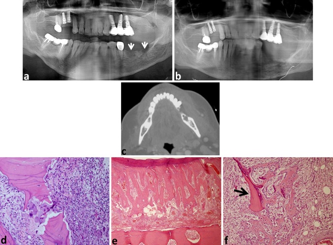 Fig. 4