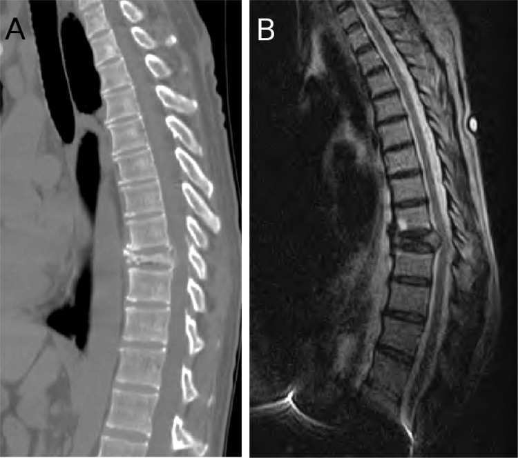 Fig. 1A & 1B