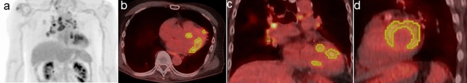 Fig. 2