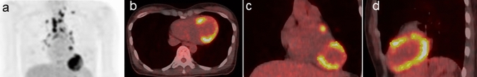 Fig. 1