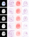 Fig. 13