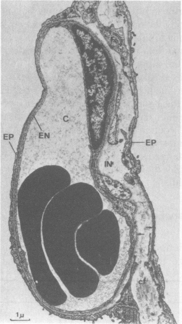 graphic file with name westjmed00103-0070-b.jpg