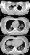 Fig. 1