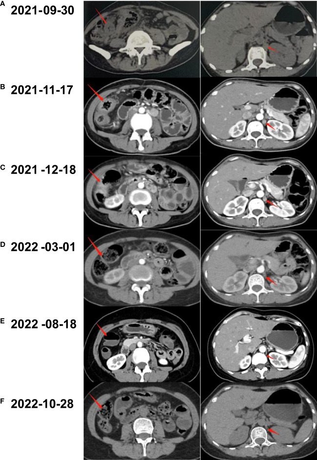 Figure 2