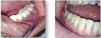 Fig. (3)