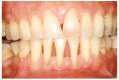 Fig. (2)