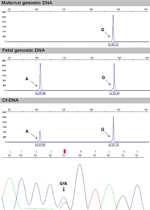 Fig. 2