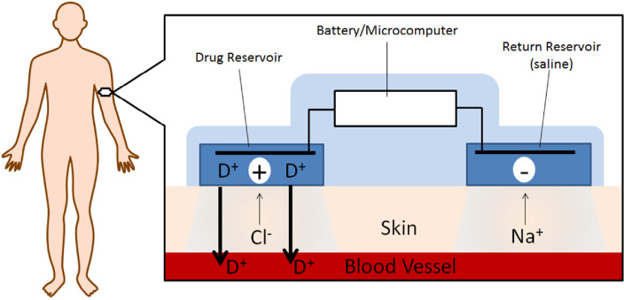 Fig. 4