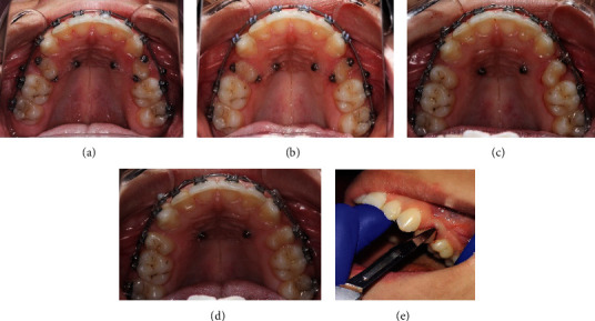 Figure 4