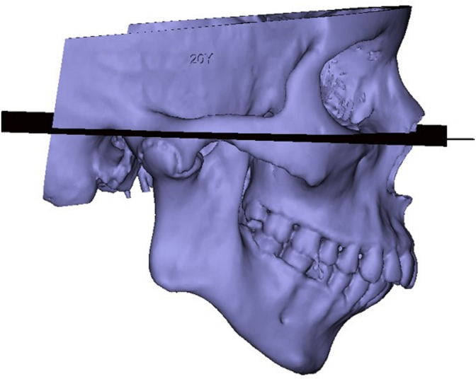 Fig. 3