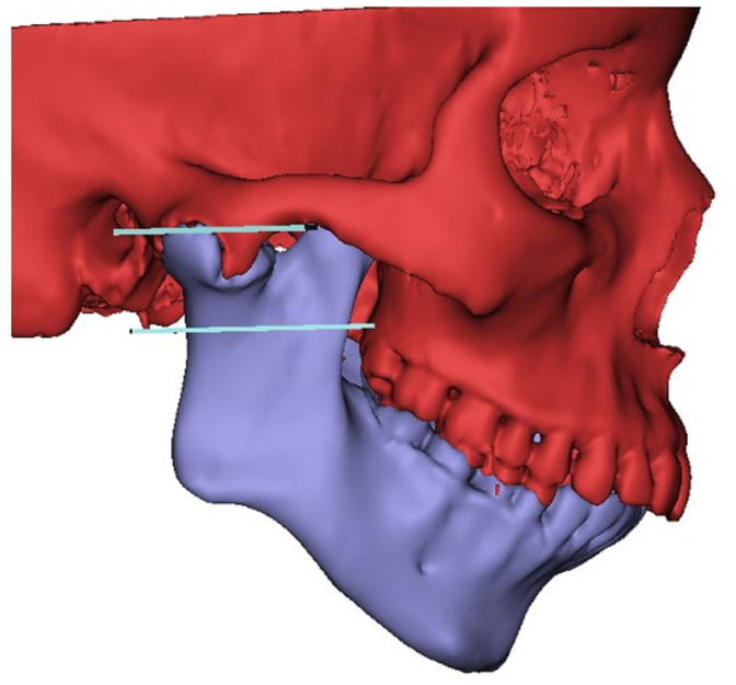 Fig. 4