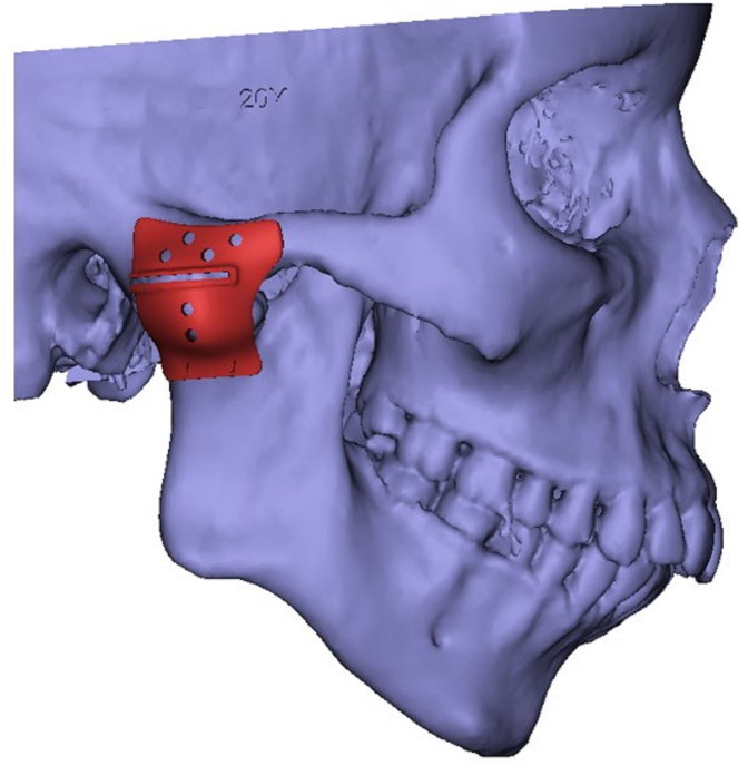 Fig. 5