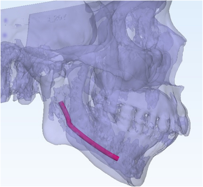 Fig. 6