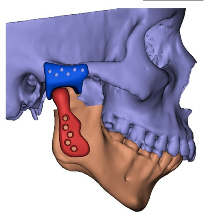 Fig. 8