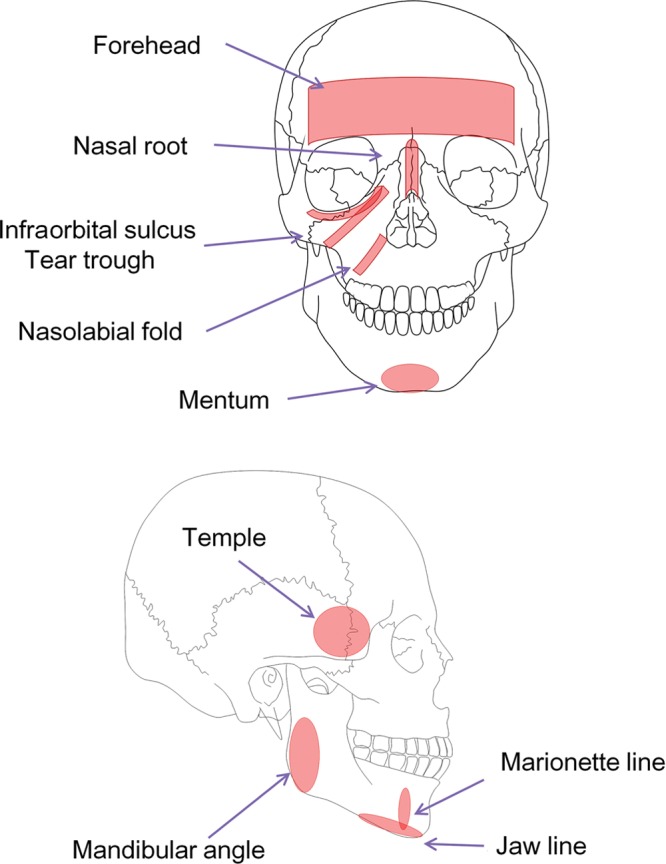 Figure 12.