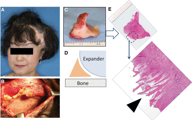 Figure 11.