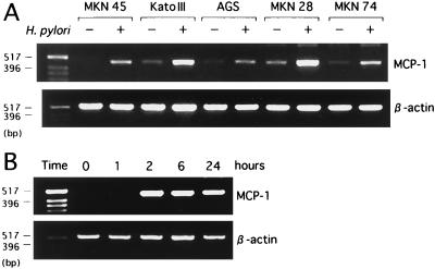 FIG. 1