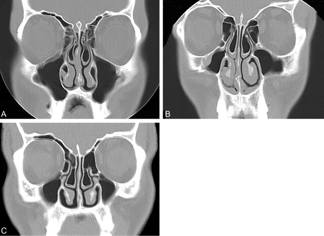 Fig 4.