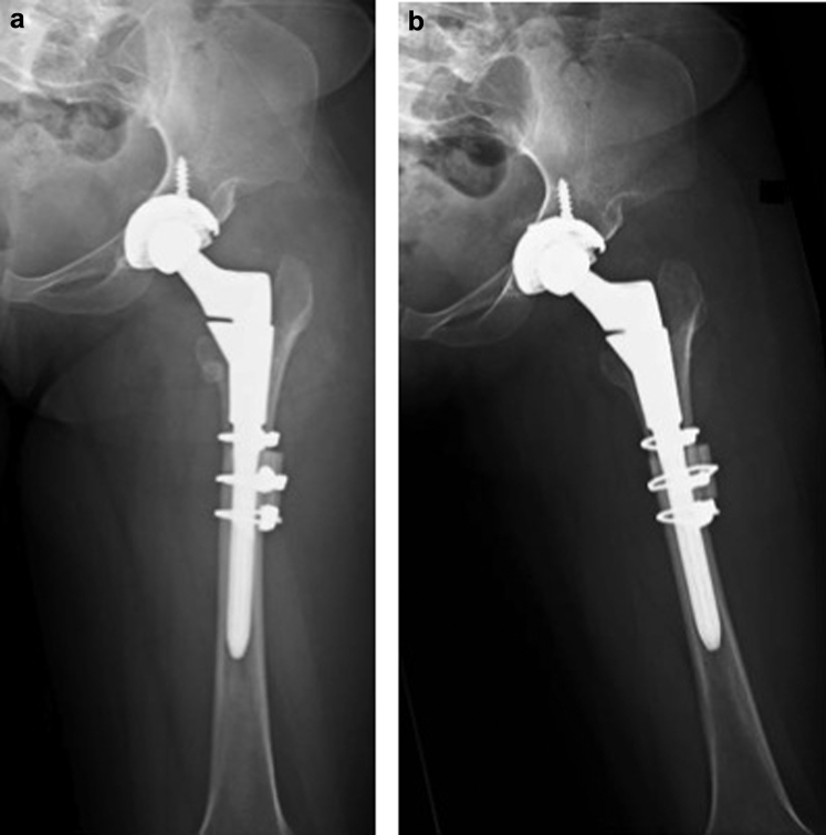 Figure 4