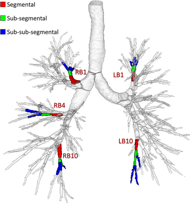 Illustration of segmental, subsegmental, and sub-subsegmental generations along the five standardized bronchopulmonary paths: RB1 (apical segment of right upper lobe), RB4 (lateral segment of right middle lobe), RB10 (posterobasal segment of right lower lobe), LB1 (apicoposterior segment of left upper lobe), and LB10 (posterobasal segment of left lower lobe).