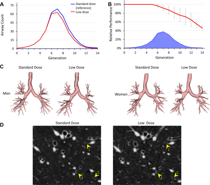 Comparative results of airway detection at standard-dose (reference) and low-dose CT imaging. (A) Generational distribution of mean airway counts at standard-dose (blue) and low-dose (red) CT. (B) Mean and SD of the relative performance at different airway generations at low-dose CT (red). Mean reference airway counts at standard-dose CT are shown at the bottom (blue). (C) Representative examples of segmented airways at standard- and low-dose CT for men and women. (D) CT image slices show examples of airways (yellow arrowheads) that are detected at standard-dose CT but missed at low-dose CT. CT display settings: level, −450 HU; window, 1200 HU.