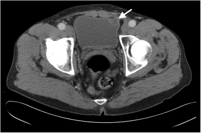 FIG. 1.