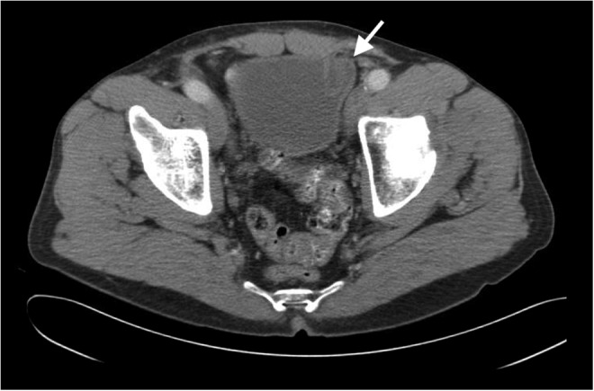 FIG. 2.