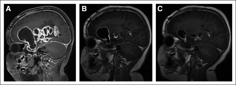 FIG 2.