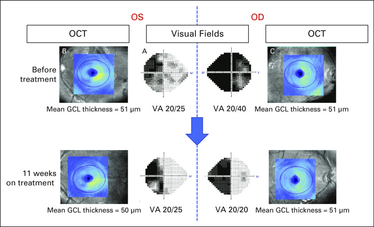 FIG 3.