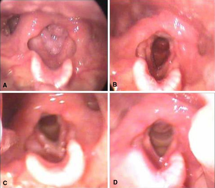 Fig. 1