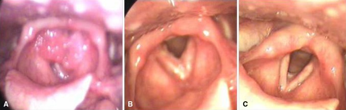 Fig. 3