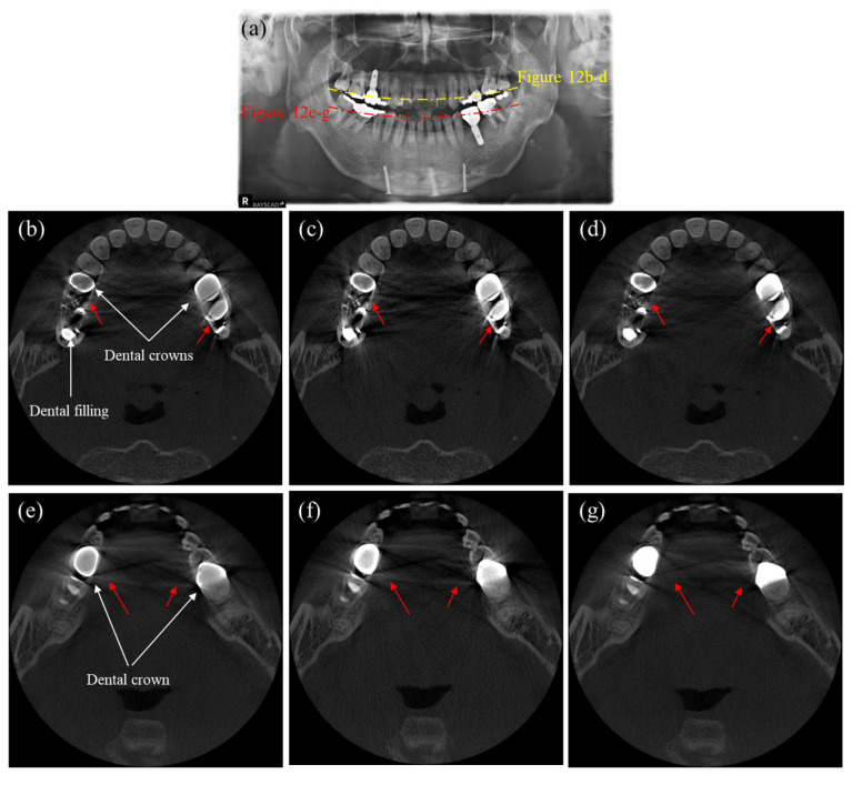 Figure 12