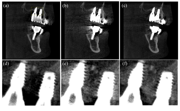 Figure 13