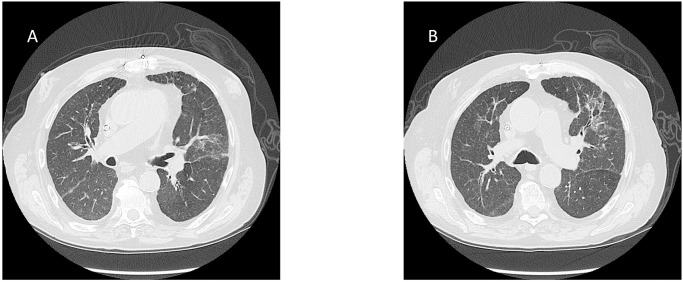 Fig 4