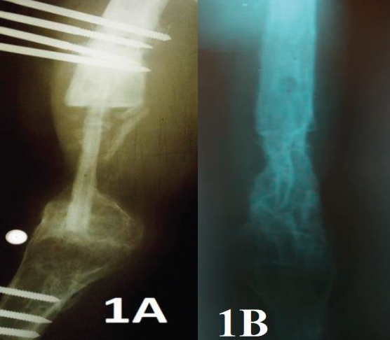 Figure 1a, 1b