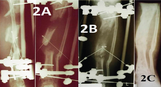 Figure 2a, 2b, 2c