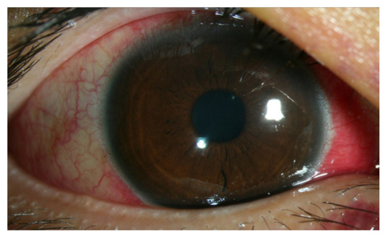 Fig. 3