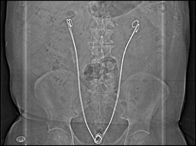 Figure 2.