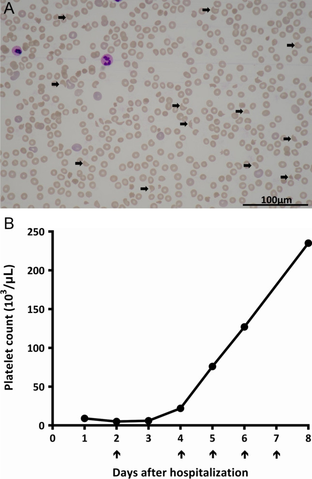 Fig. 1