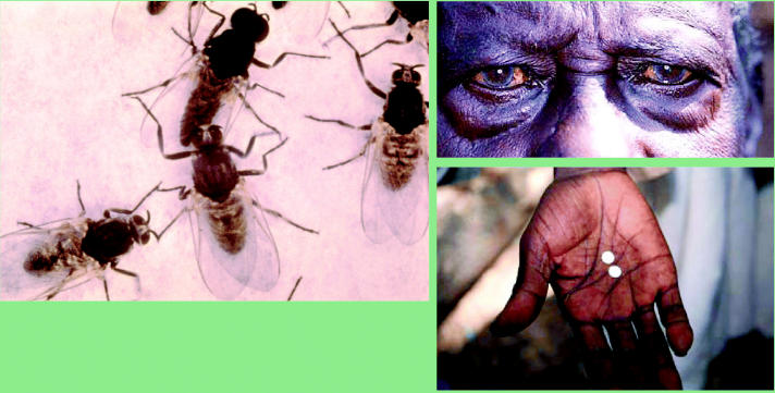 Focusing on onchocerciasis.